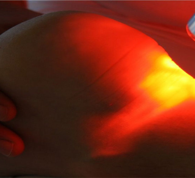 laserterapia