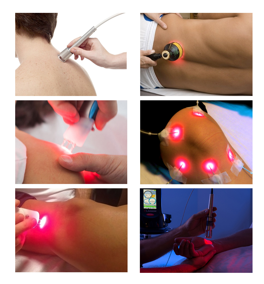 laser terapia